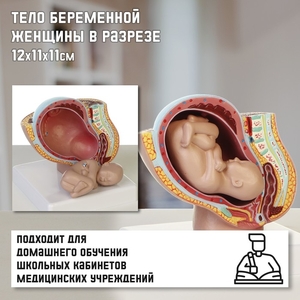 Анатомическая модель «Макет тела беременной женщины», в разрезе, 12×11×11 см