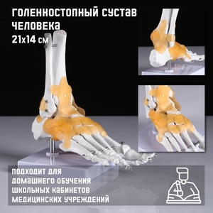 Анатомическая модель «Макет голеностопного сустава», 21×20 см